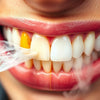 Does Vaping Stain Your Teeth | Effects on Dental Health - Mister Vape