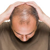 Can vaping cause hair loss? - Mister Vape
