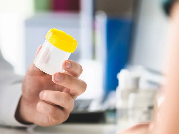 Does CBD Show Up on Drug Tests UK? A Comprehensive Guide - Mister Vape